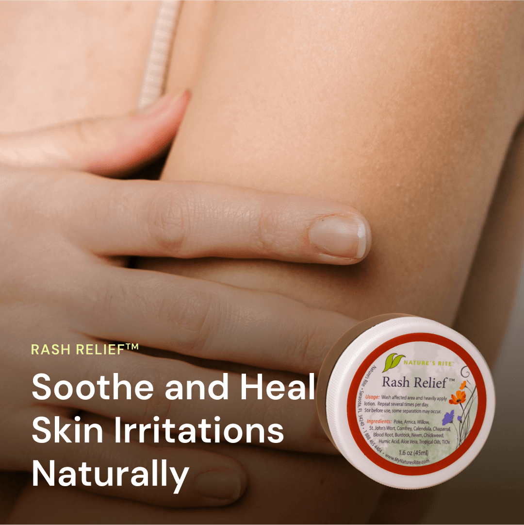 Rash Relief – Mother Earth News
